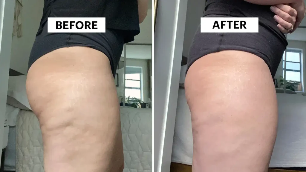 Do Toning Exercise Bagshot Really Tackle Cellulite?