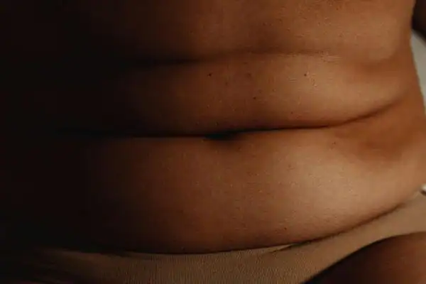 image of what stress can do on the stomach area and how Lipo 360 Bagshot can help to change your body shape.