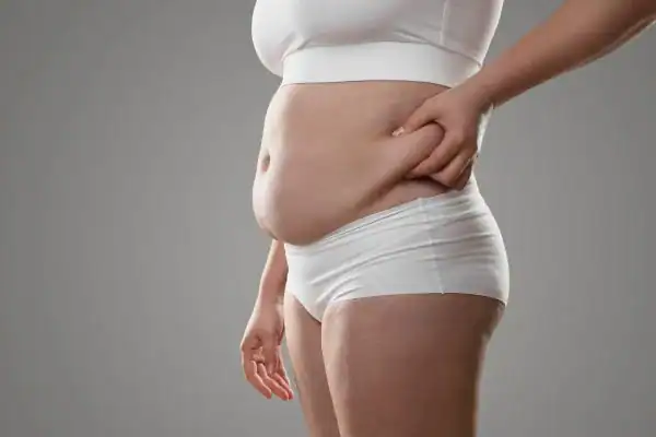Image of stress belly Bagshot How Lipo 360 can help manage your symptoms
