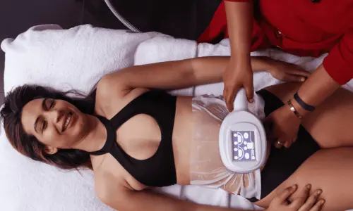 Woman having Body Sculpting treatment post injury Bagshot